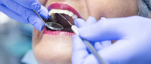 Best Dental Abscess Treatment in Kean University, NJ